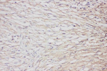 GFAP Rabbit Polyclonal Antibody