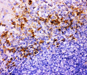 Integrin beta 1/ITGB1 Rabbit Polyclonal Antibody