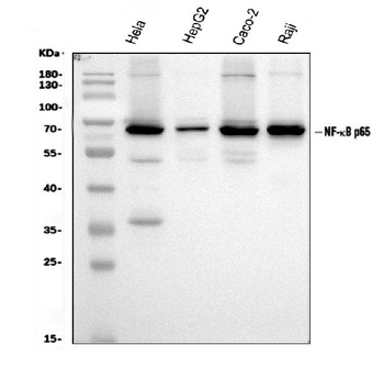 NF-kB p65/RELA/NF Rabbit Polyclonal Antibody