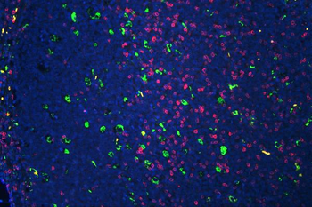 CD3 epsilon/CD3E Antibody