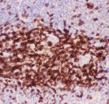 CD3 epsilon/CD3E Antibody