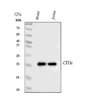 CD3 epsilon/CD3E Antibody
