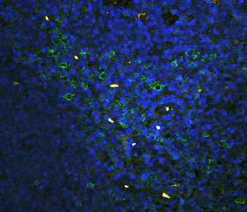 CD43/SPN Rabbit Polyclonal Antibody