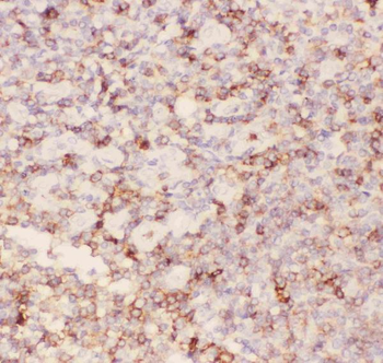 CD43/SPN Rabbit Polyclonal Antibody