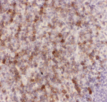 CD43/SPN Rabbit Polyclonal Antibody