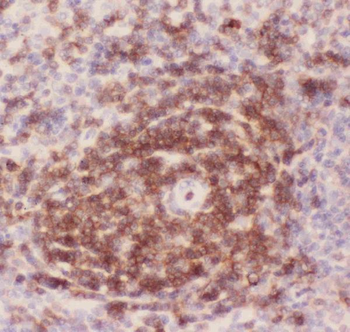 CD43/SPN Rabbit Polyclonal Antibody