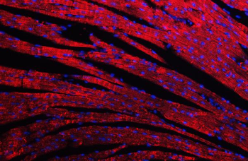Desmin Rabbit Polyclonal Antibody