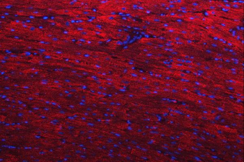 Desmin Rabbit Polyclonal Antibody