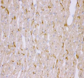 Desmin Rabbit Polyclonal Antibody