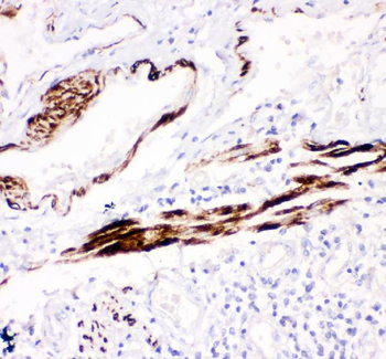 Desmin Rabbit Polyclonal Antibody