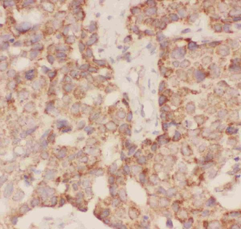 FSH beta/FSHB Rabbit Polyclonal Antibody