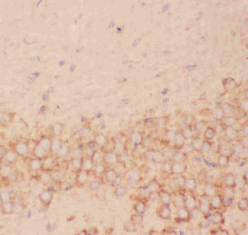 FSH beta/FSHB Rabbit Polyclonal Antibody