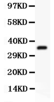 FSH beta/FSHB Rabbit Polyclonal Antibody