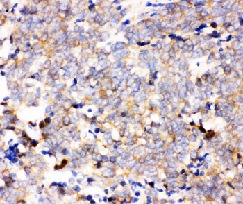 IKK alpha/CHUK Rabbit Polyclonal Antibody