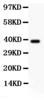 RIP/RIPK1 Rabbit Polyclonal Antibody