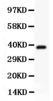 Hamartin/TSC1 Rabbit Polyclonal Antibody