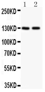 Hamartin/TSC1 Rabbit Polyclonal Antibody