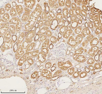 NUDT19 Rabbit Polyclonal Antibody