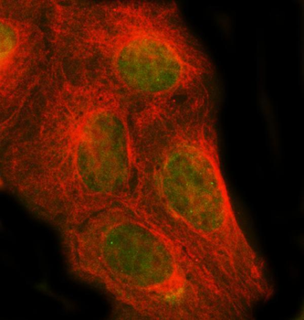 PSMC1 Rabbit Polyclonal Antibody