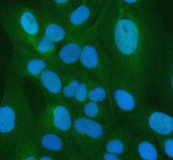 PSMA5 Rabbit Polyclonal Antibody