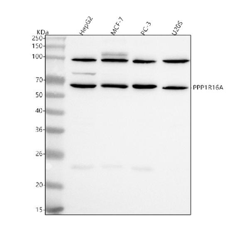PPP1R16A Rabbit Polyclonal Antibody