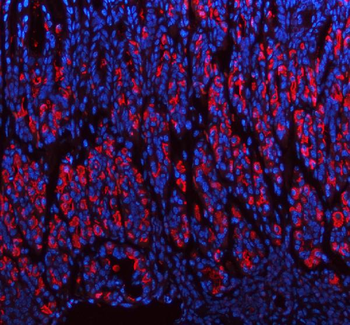 ATP4B Rabbit Polyclonal Antibody