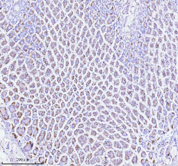 ATP4B Rabbit Polyclonal Antibody