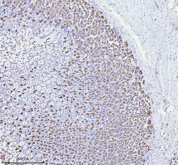 ATP4B Rabbit Polyclonal Antibody