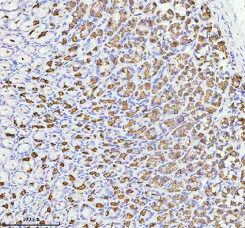ATP4B Rabbit Polyclonal Antibody