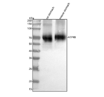 ATP4B Rabbit Polyclonal Antibody