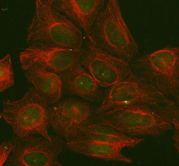 POGK Rabbit Polyclonal Antibody