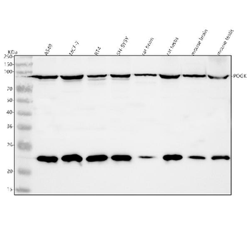 POGK Rabbit Polyclonal Antibody