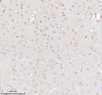 MECP2 Rabbit Polyclonal Antibody