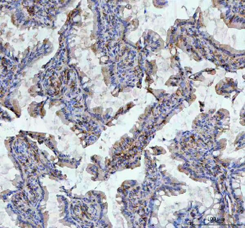 CD44 Antibody