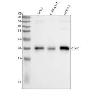 CD3D Rabbit Polyclonal Antibody
