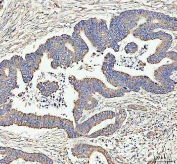 LARG/ARHGEF12 Rabbit Polyclonal Antibody