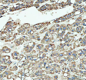 LARG/ARHGEF12 Rabbit Polyclonal Antibody