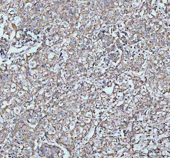 LARG/ARHGEF12 Rabbit Polyclonal Antibody