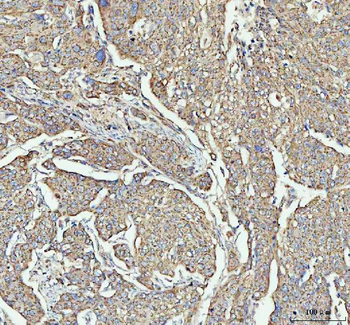 LARG/ARHGEF12 Rabbit Polyclonal Antibody