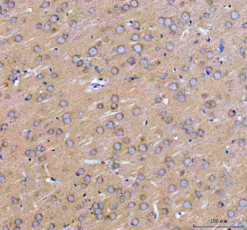 LARG/ARHGEF12 Rabbit Polyclonal Antibody
