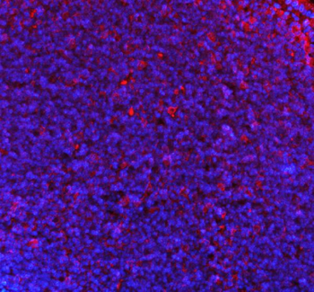 p47 phox/NCF1 Rabbit Polyclonal Antibody