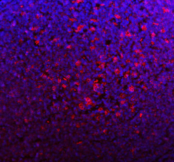 p47 phox/NCF1 Rabbit Polyclonal Antibody