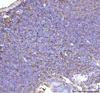 p47 phox/NCF1 Rabbit Polyclonal Antibody