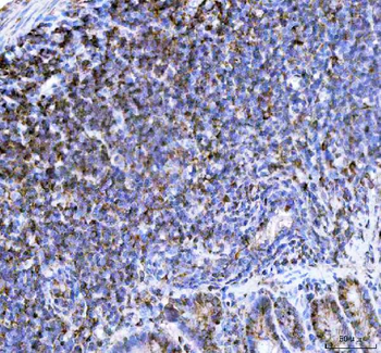 p47 phox/NCF1 Rabbit Polyclonal Antibody