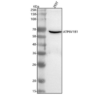 ATP6V1B1 Rabbit Polyclonal Antibody