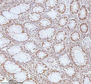 ASH2L Antibody