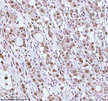 ASH2L Antibody