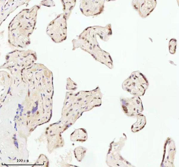 ASH2L Antibody