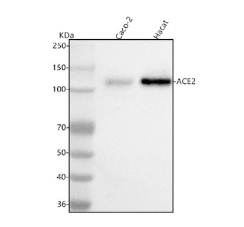 ACE2 Rabbit Polyclonal Antibody