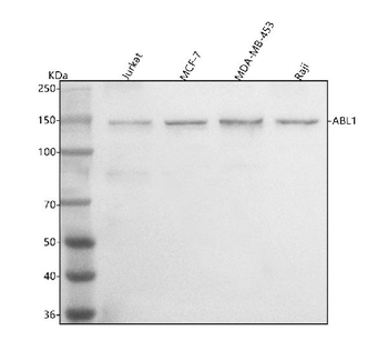 ABL1 Rabbit Polyclonal Antibody